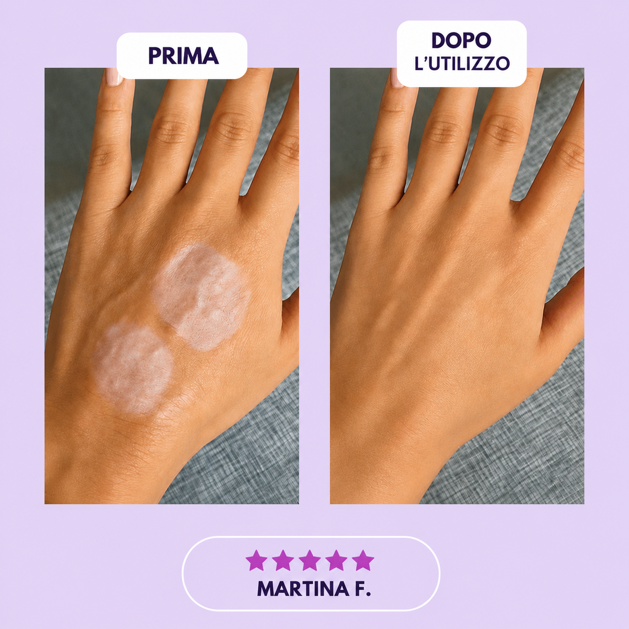 Nastro al Collagene in Silicone – Patch Levigante per Rughe e Cicatrici