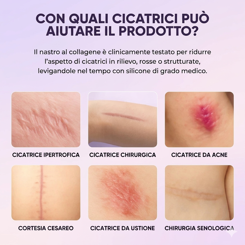 Nastro al Collagene in Silicone – Patch Levigante per Rughe e Cicatrici